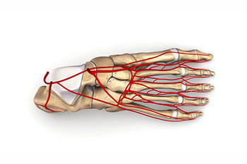 Pad treatment in the Toronto, Scarborough, Markham, Richmond Hill, Oshawa, Vaughan, Brampton, Mississauga, Oakville Ontario areas