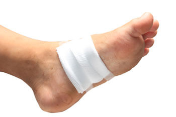Diabetic Ulcers Treatment in the Toronto, Scarborough, Markham, Richmond Hill, Oshawa, Vaughan, Brampton, Mississauga, Oakville Ontario areas
