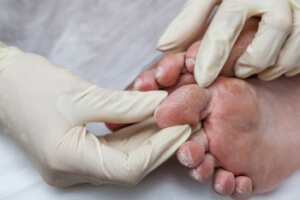 Essential Tips for Diabetic Foot Health