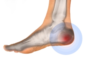 Why Heel And Rearfoot Pain Is Common in Older Adults