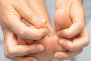 Risk Factors of Athlete’s Foot
