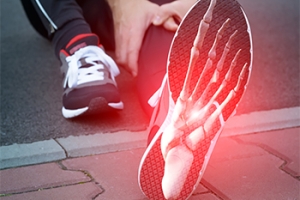 Understanding Stress Fractures in the Feet